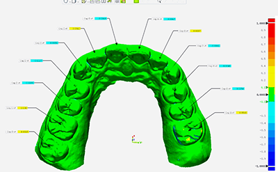 XL013 Dental Aoralscan 3